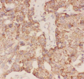 Anti-FSH beta/FSHB Antibody