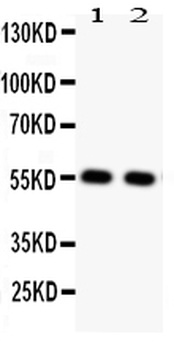 Glucose Transporter GLUT4/SLC2A4 Antibody