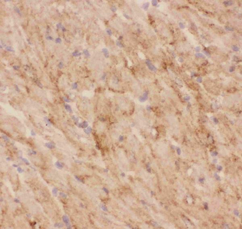 Anti-Glucose Transporter GLUT4/SLC2A4 Antibody