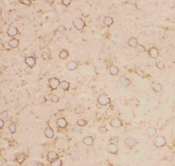 Anti-Kv2.1/KCNB1 Antibody