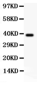 Anti-RIP/RIPK1 Antibody