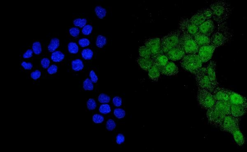 Anti-Ubiquitin/UBB Antibody