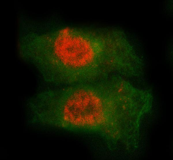 Anti-MED7 Antibody