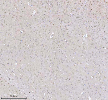Anti-MECP2 Antibody