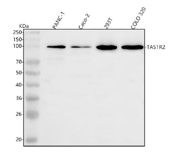 Anti-TAS1R2 Antibody