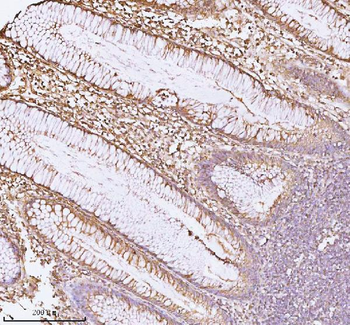 Anti-CD44 Antibody