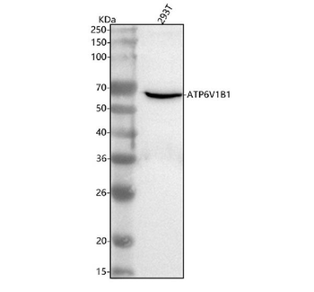 Anti-ATP6V1B1 Antibody
