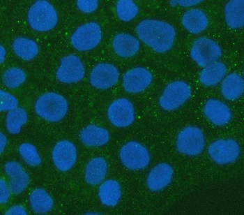 Anti-XRN1 Antibody