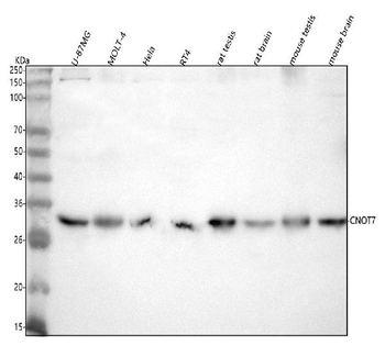 Anti-CNOT7 Antibody