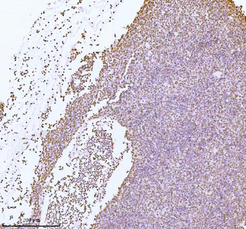 Anti-ASH2L Antibody
