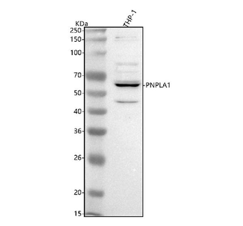 Anti-PNPLA1 Antibody