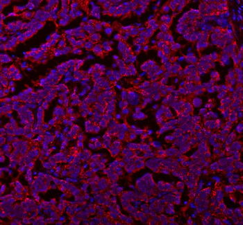 Anti-SLC7A7 Antibody