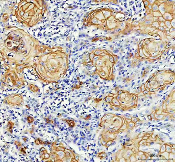 Anti-LY6D Antibody