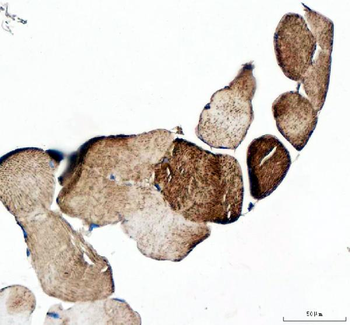 Anti-MYOT Antibody