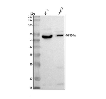Anti-MFSD4A Antibody