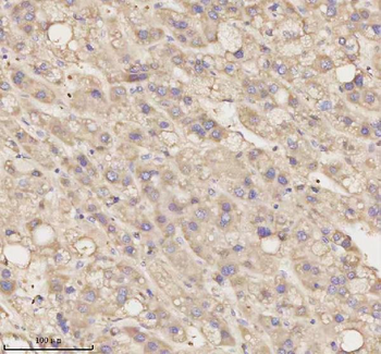 Anti-MEST Antibody