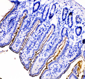 Anti-MEP1B Antibody
