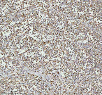 Anti-MELTF Antibody