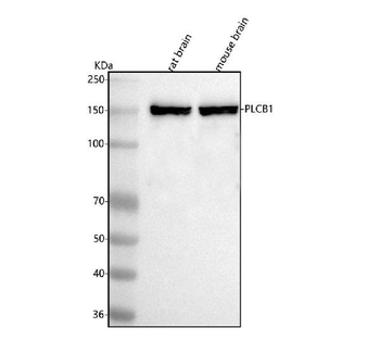 Anti-PLCB1 Antibody