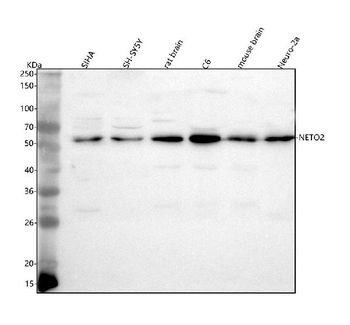 Anti-NETO2 Antibody