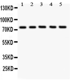 12 Lipoxygenase/ALOX12 UBB Antibody
