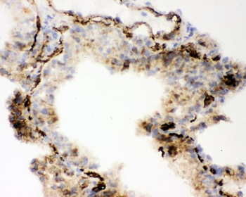Anti-Angiotensin Converting Enzyme 1/ACE Antibody