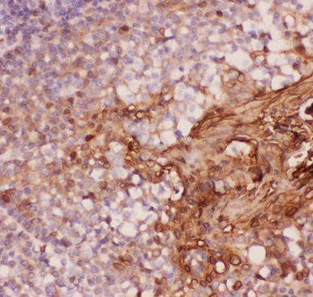 Anti-Annexin A1/ANXA1 Antibody
