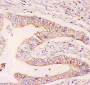 Anti-MCL1 Antibody
