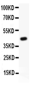 MRP4/ABCC4 Antibody