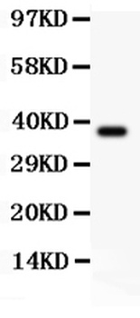 Sodium/Hydrogen Exchanger 1/SLC9A1 Antibody