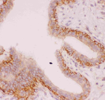 Anti-Sodium/Hydrogen Exchanger 1/SLC9A1 Antibody