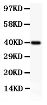 Perforin/PRF1 Antibody