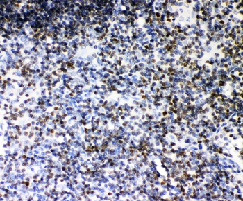 Anti-RUNX1/AML1 Antibody