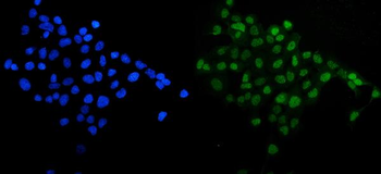 Anti-SIRT1 Antibody