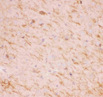 Anti-SIRT2 Antibody