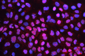 Anti-CD79b Antibody