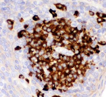 Anti-CD82 Antibody