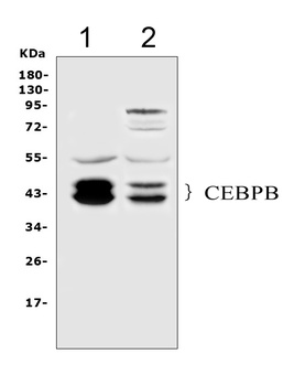 CEBP Beta/CEBPB Antibody