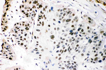 Anti-KAT3B/p300/EP300 Antibody