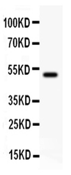 EPB41L1 Antibody