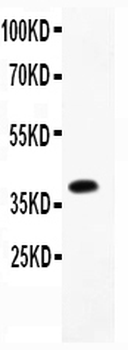 Anti-Furin Antibody