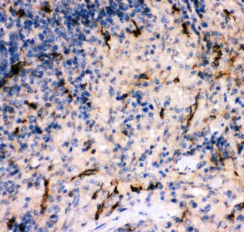Anti-C5/C5a Antibody