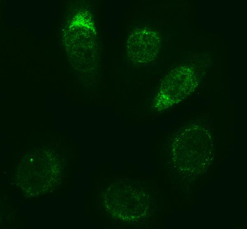 Anti-Caspase-3/CASP3 Antibody