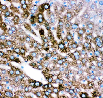 Anti-Cytochrome P450 2E1/CYP2E1 Antibody