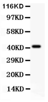 Anti-EDA Antibody