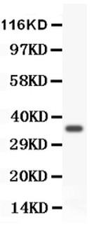 Anti-FOXM1 Antibody