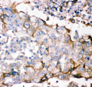 Anti-GDNF Receptor alpha 1/GFRA1 Antibody