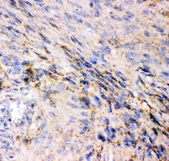 Anti-Glutamate Receptor 1/GRIA1 Antibody