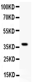 GRIK1 Antibody