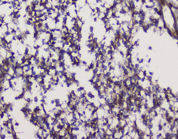 Anti-GRIK1 Antibody